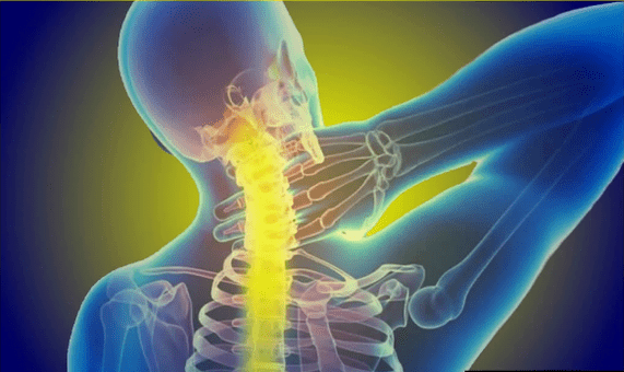 Departamentul cervical doare