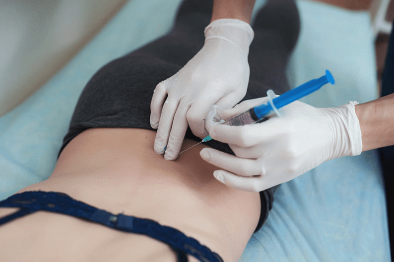blocaj pentru osteocondroza lombară
