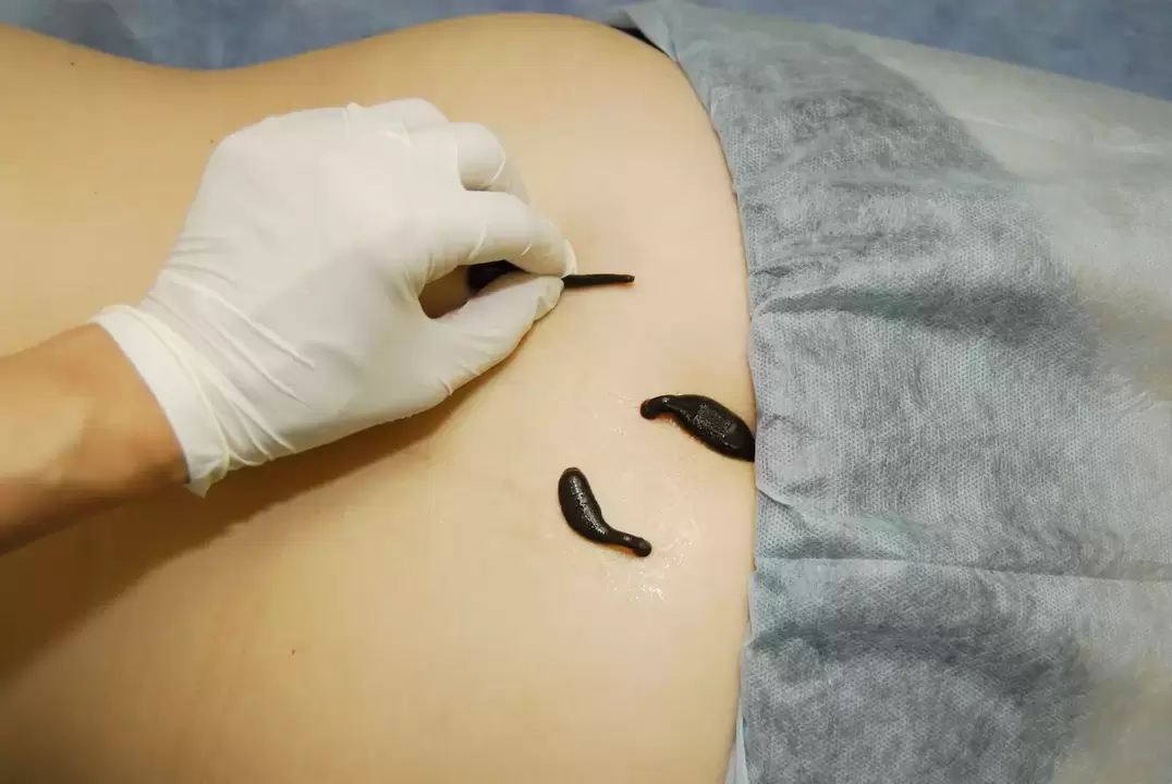 plasarea lipitorilor pentru osteocondroza lombară