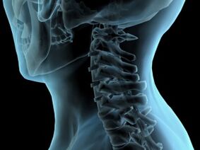 vertebrele cervicale cu osteocondroză