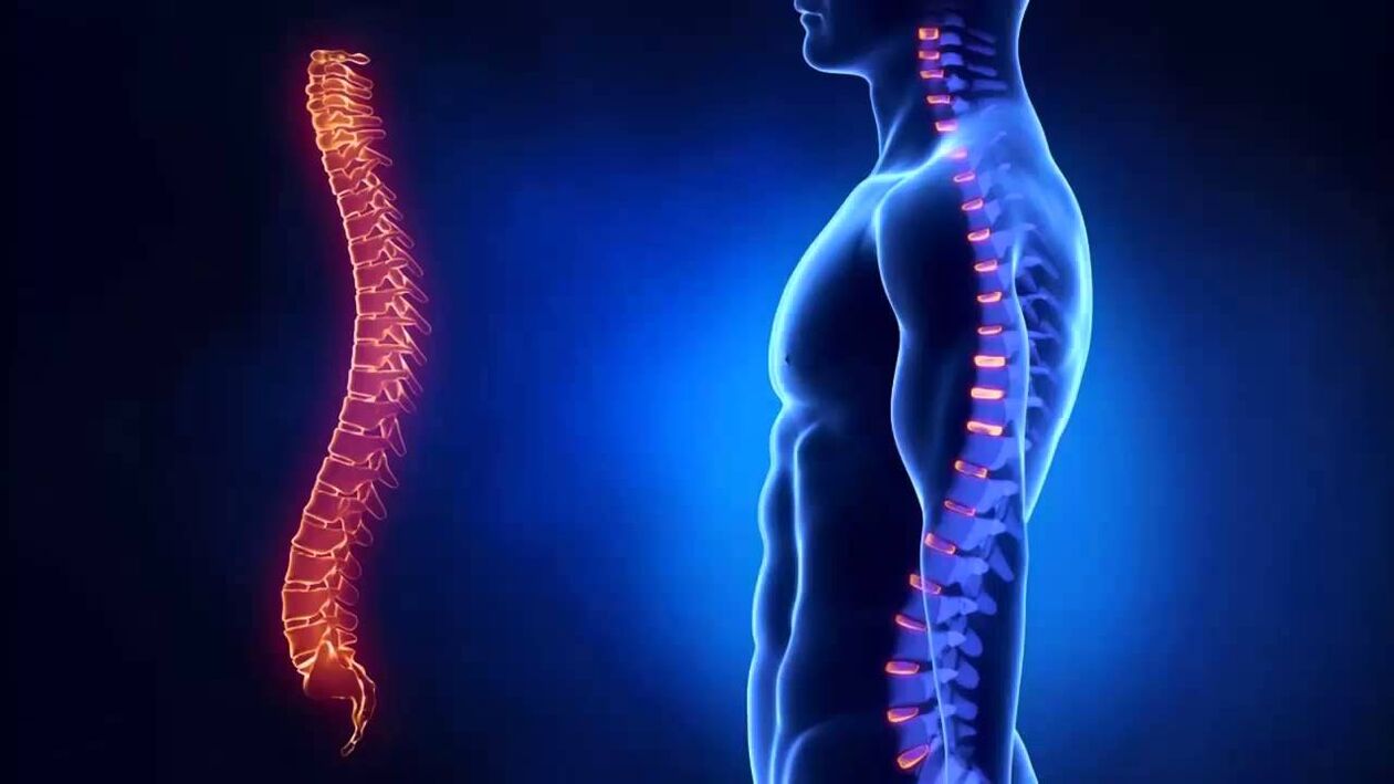 osteochondroză