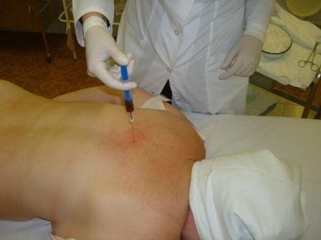 Tratamentul injecțiilor